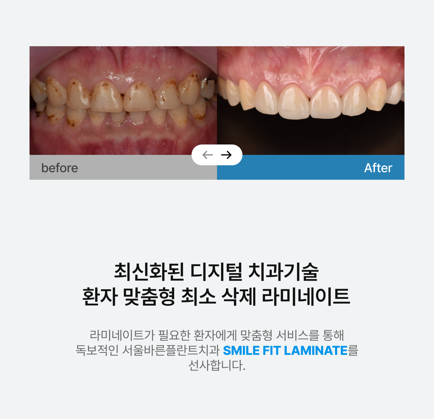 치과 랜딩 페이지 메인 이미지 2